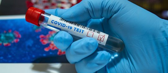 коронавірус